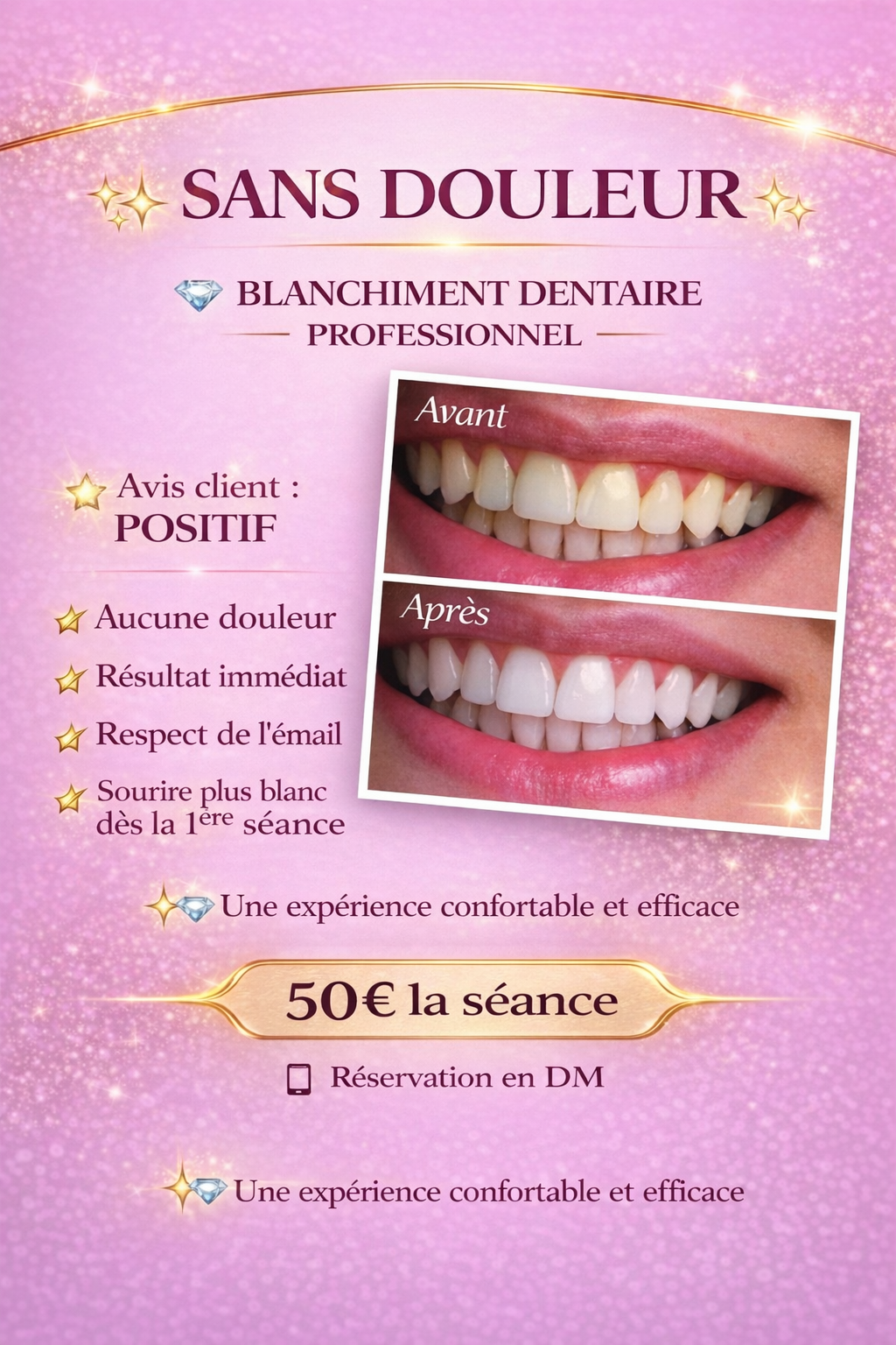 Milaya Beautyy/ Blanchiment Dentaire  - Maquilleur a Grenoble